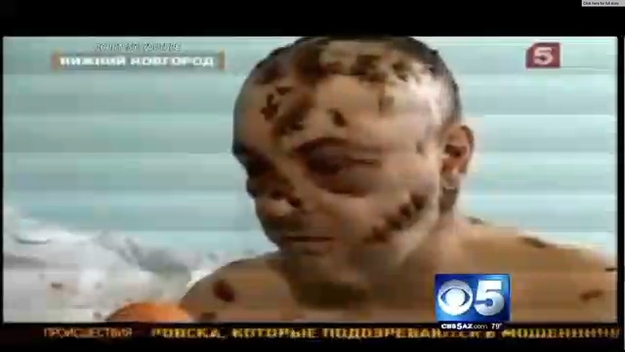 Krokodil'in İlk Etkileri